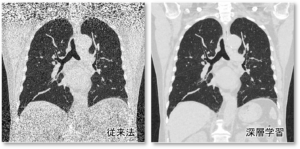 Image enhancement of medical CT scans using deep learning